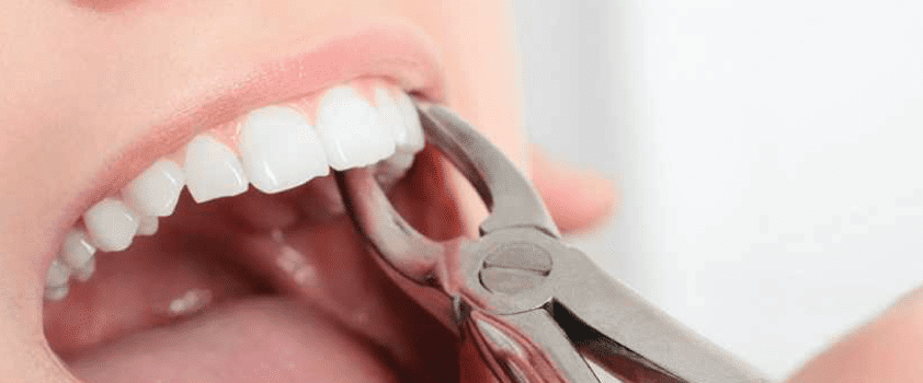 DentalAnxiety