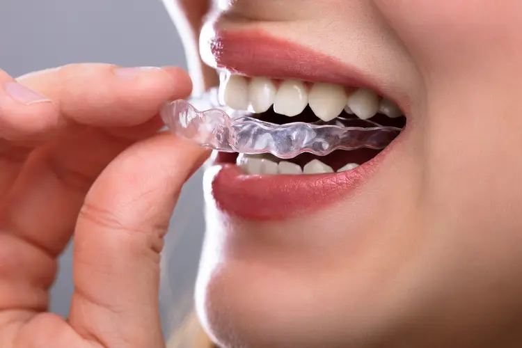 Invisalign Care Tips