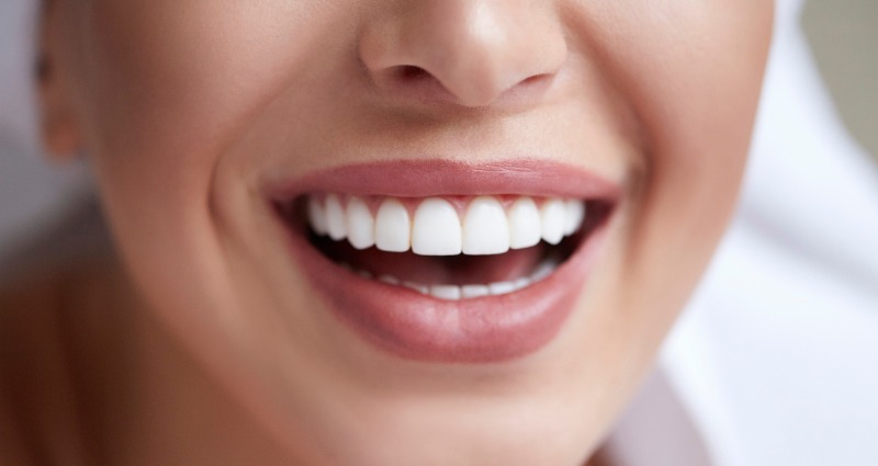 Invisalign with Elastics to Fix Complex Bites - Park Dental Care Hyderabad