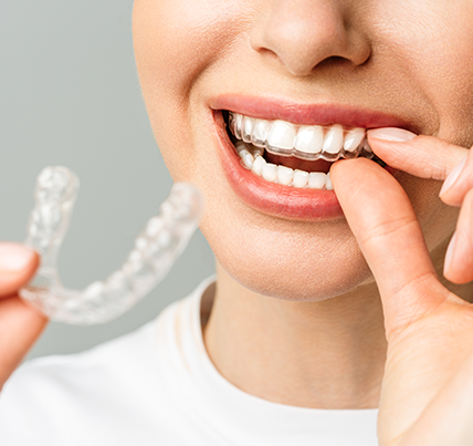 The Definitive Guide to Dental Costs - Park Dental Care