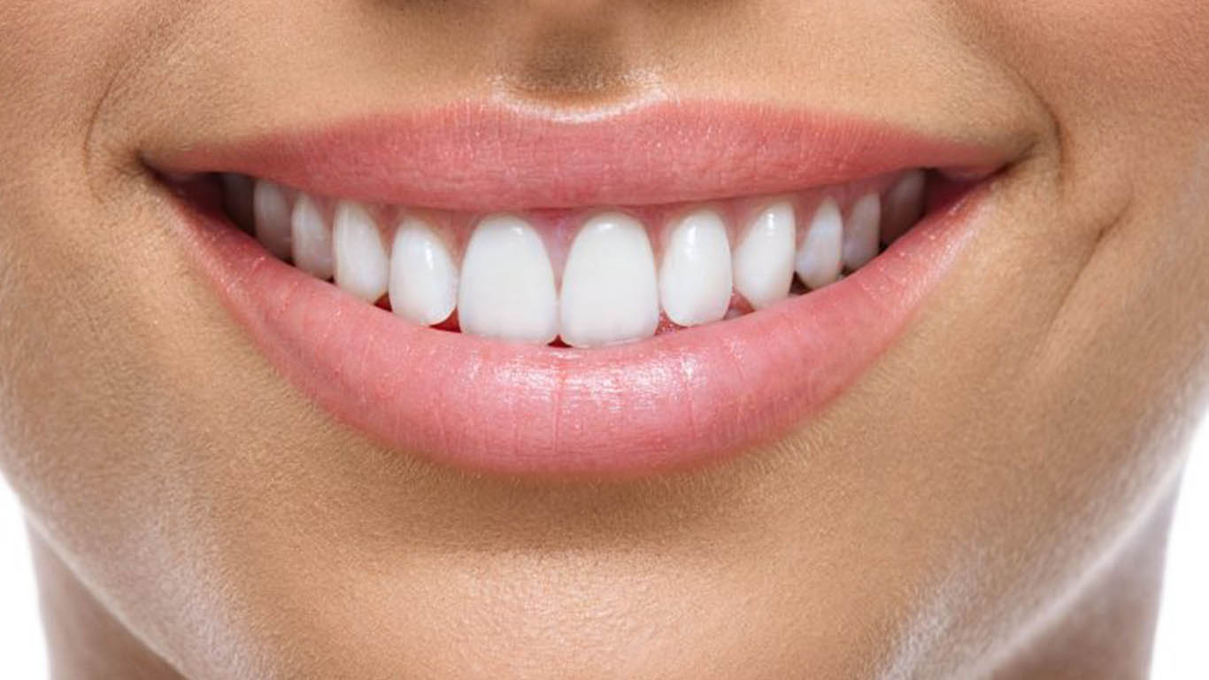 Smile Design