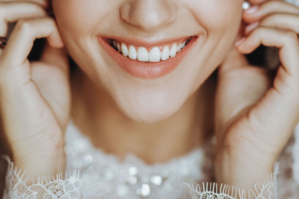 Hyderabad Wedding Smile Invisalign Guide