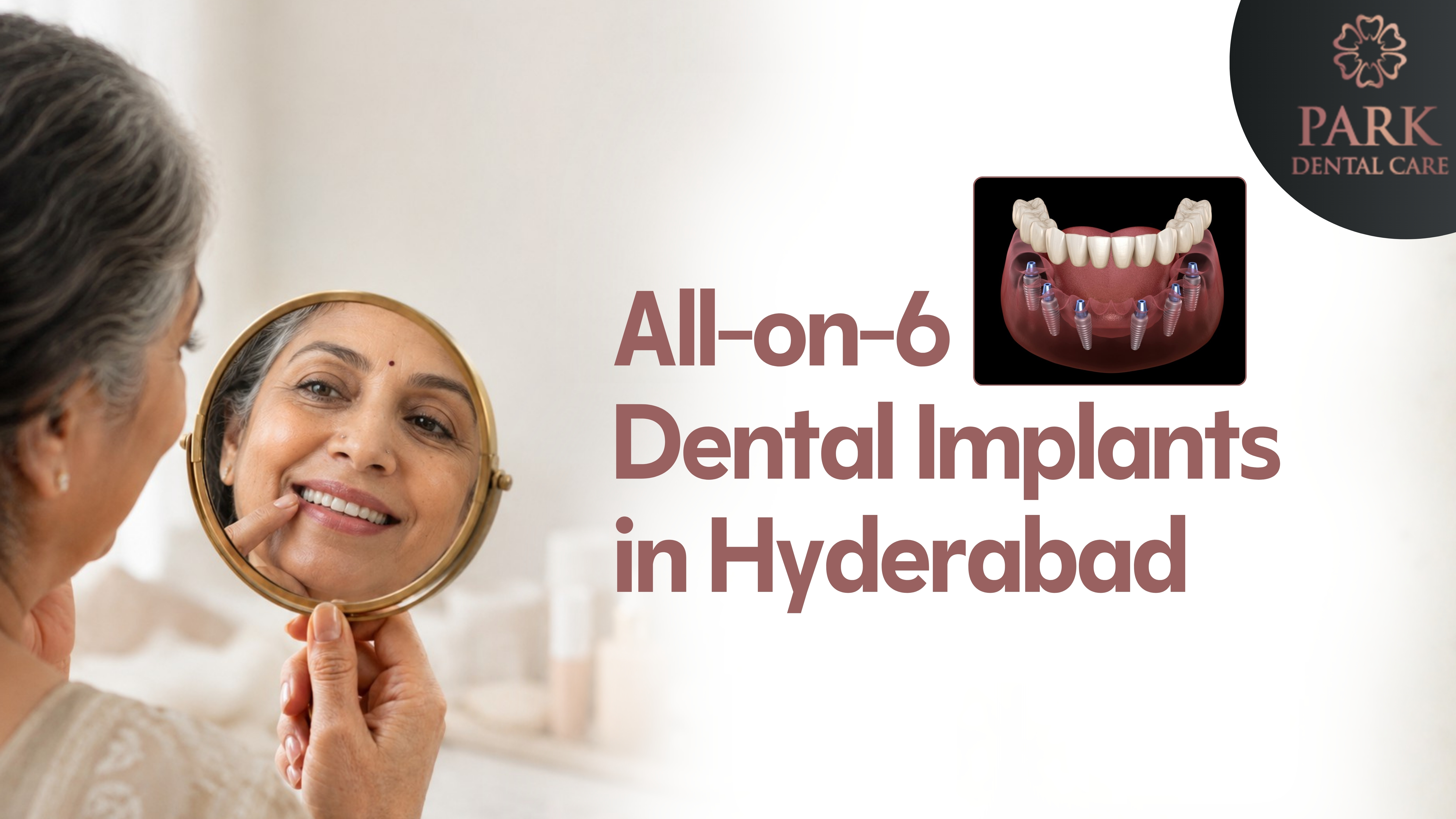 All-on-6 Dental Implants in Hyderabad at Park Dental Care