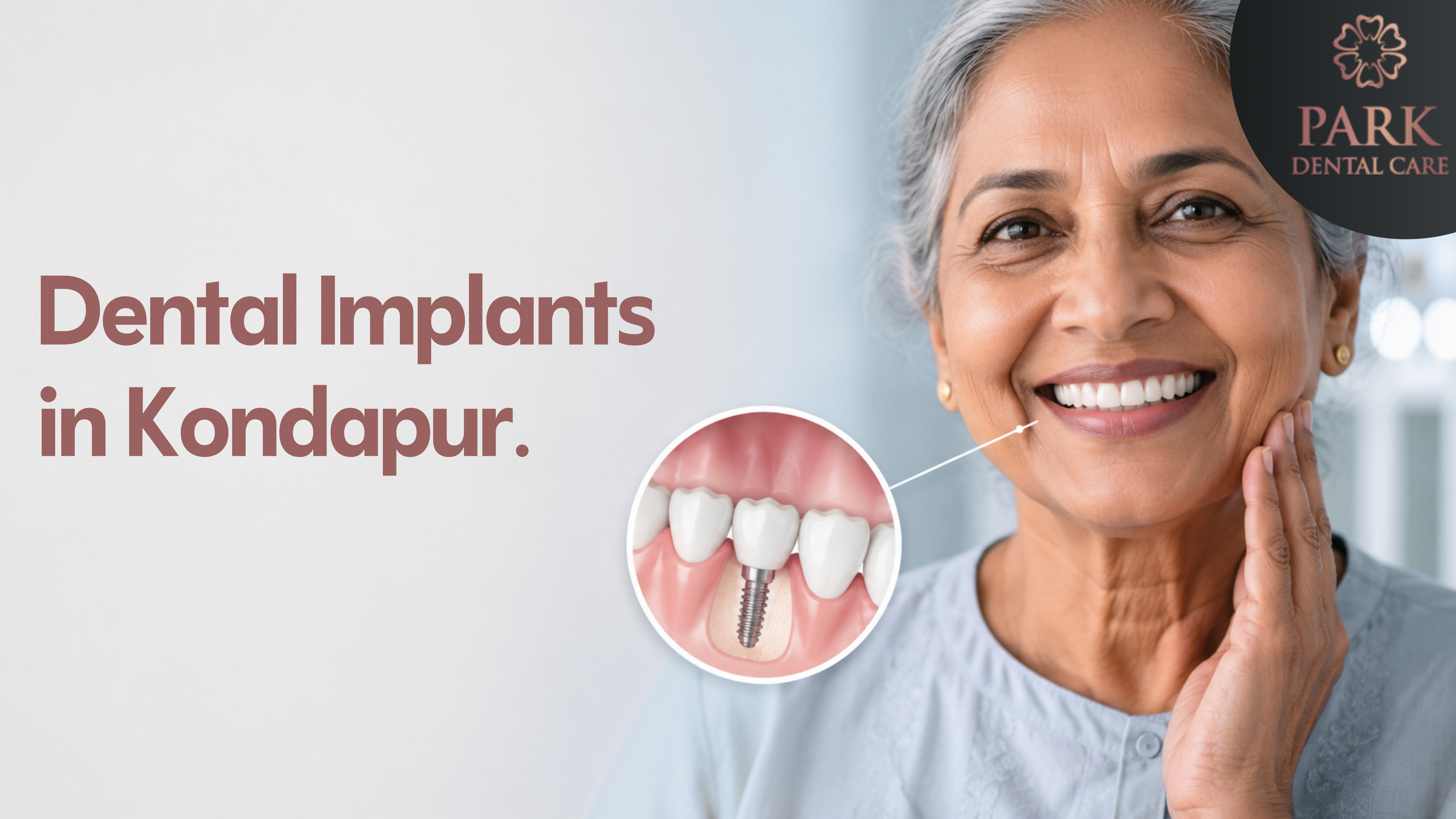 Dental implants in Kondapur, Hyderabad at Park Dental Care
