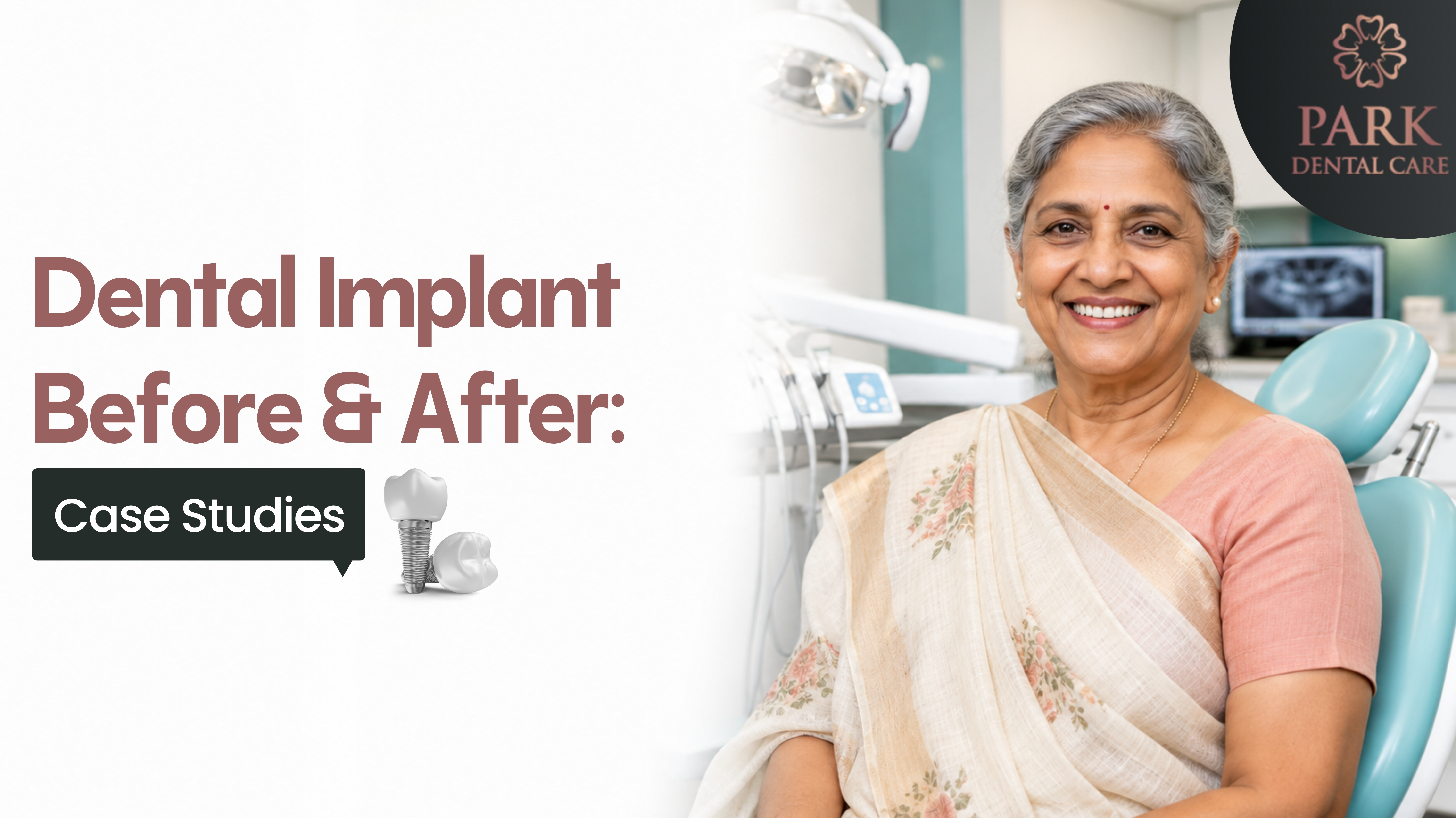 Dental Implant Before and After Case Studies at Park Dental Care Hyderabad