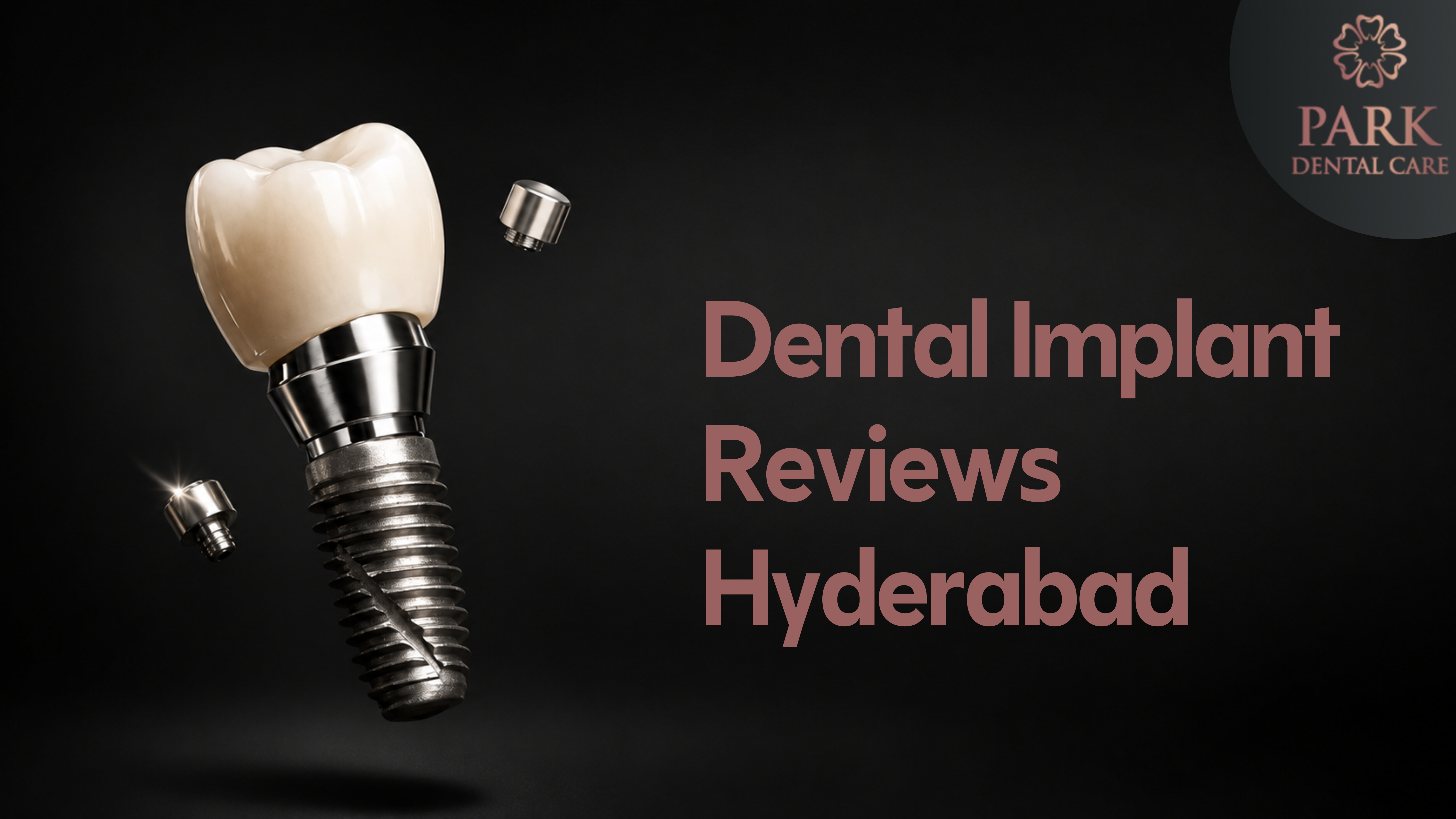 Dental Implant Reviews and Testimonials at Park Dental Care Hyderabad