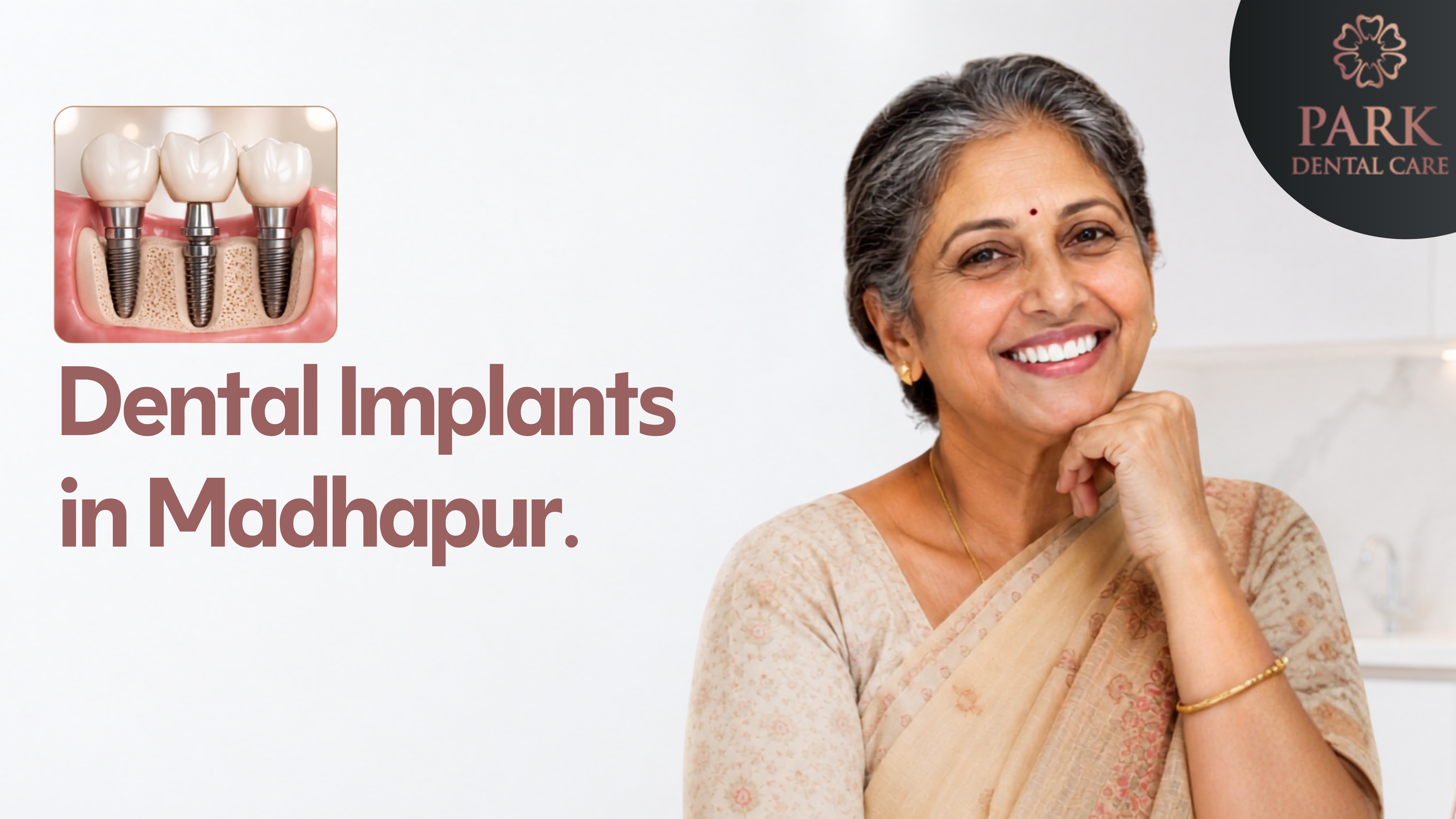 Dental implants in Madhapur, Hyderabad at Park Dental Care