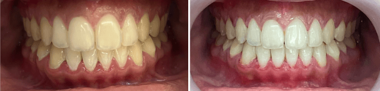 DentalAnxiety